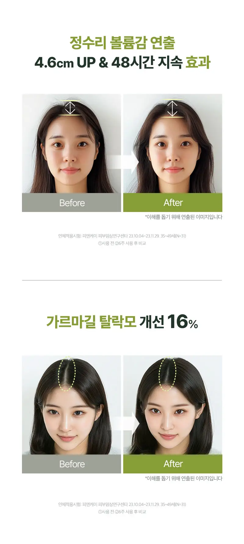 [소용량한정] 려 루트젠 여성맞춤볼륨 탈모증상전문케어 샴푸 242ML 상세페이지 14